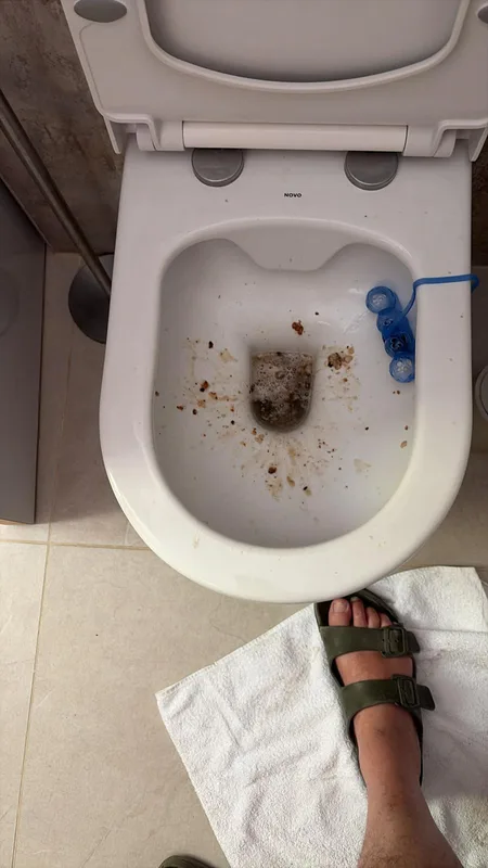 WC bouché avant intervention de débouchage